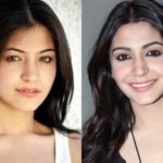 Anushka-Sharma-plastic-surgery