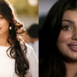 Ayesha-Takia-plastic-surgery