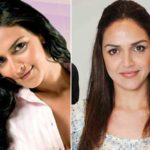 Esha-Deol-plastic-surgery