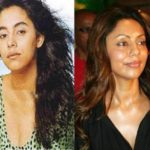 Gauri-Khan-plastic-surgery
