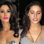 Nargis-Fakhri-Lip-Surgery