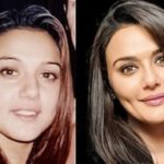 Preity-Zinta-plastic-surgery