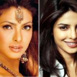 Priyanka-Chopra-plastic-surgery