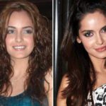 Shazahn-Padamsee-plastic-surgery