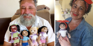 Grandfather, Crochets Dolls , Vitiligo , Children , sharp margins, pigment,