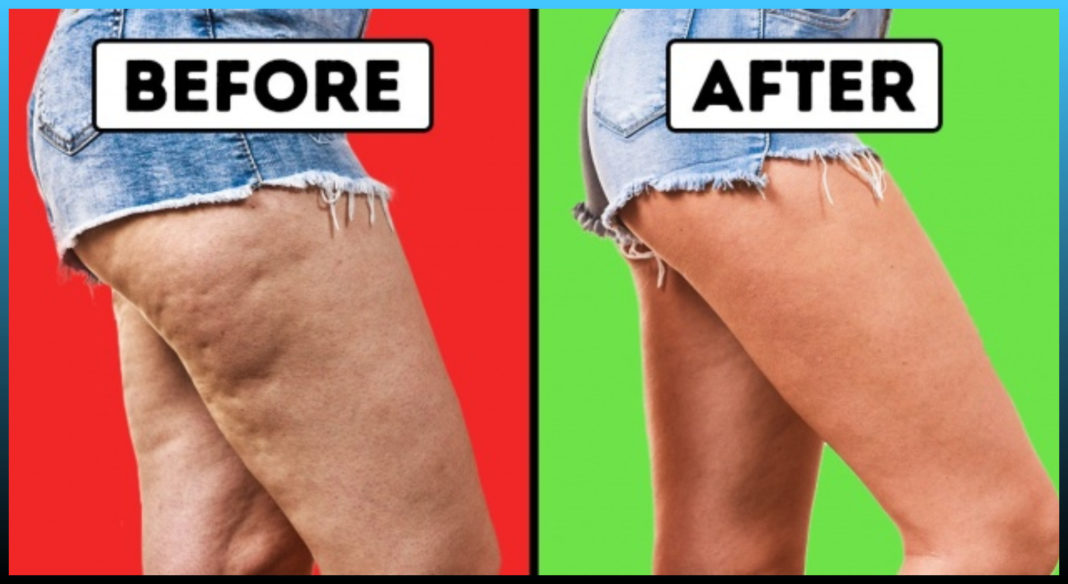 A 20 Minute Workout That Can Give You Runway Model Legs