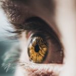 What-causes-eye-floaters