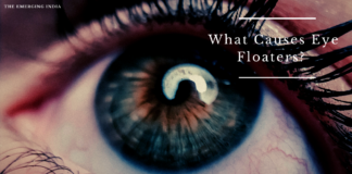What Causes Eye Floaters? Symptoms, Treatments & Causes