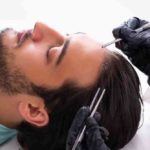 Cost-For-Hair-transplantation