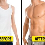 Implantation-of-muscles