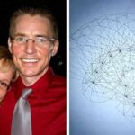 brain-injury-Jason-Padgett