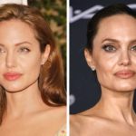 Dark-circles-appear-under-the-eyes