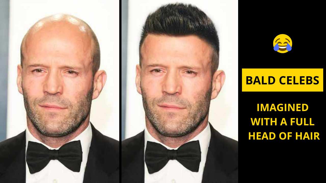 10+ Bald Celebs Imagined With a Full Head of Hair, & They Look Irresistible