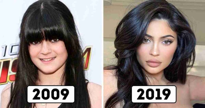 celebrities-we-couldnt-recognize-from-their-10-year-old-photos