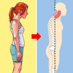 Poor-Posture-symptoms