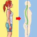 Poor-Posture-symptoms
