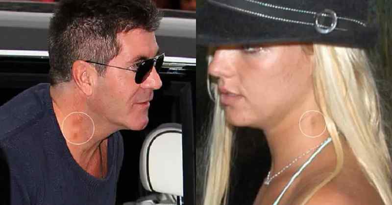 15 Times Hollywood Celebrities Were Seen With Hickeys & Love Bites