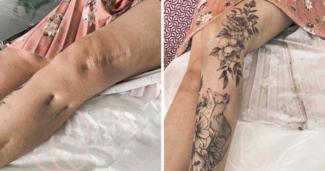 16 People Who Transformed Their Scars Into Pieces of Art