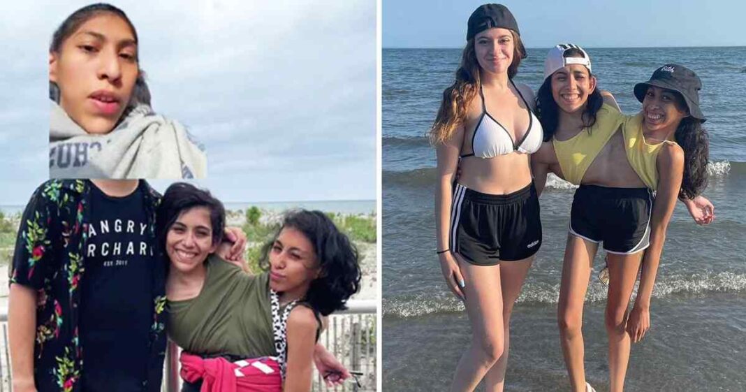 ‘I’m A Conjoined Twin, My Sister Has A BF & I Have To Third Wheel On Dates’