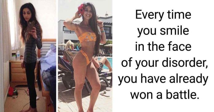 15 People Who Challenged Their Own Fate and Welcomed Their New “Me”