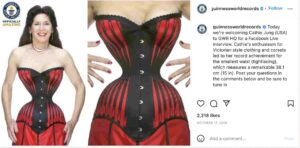 World's skinniest person: Top 5 Skinniest Person in the World