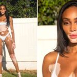 Winnie-Harlow-bf-