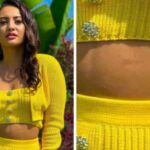 Francia-Raisa-scar-on-her-stomach