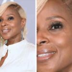 Mary-J.-Blige-mark-on-her-eye