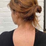 Princess-Eugenie-diagnosed-with-Scoliosis-