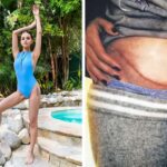 Selena-Gomez-autoimmune-illness-kidney-transplant