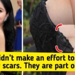 celebrities-scar-on-their-body