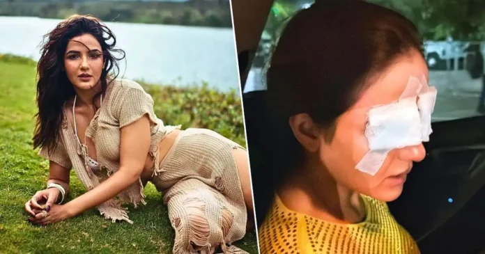 jasmin-bhasin-is-unable-to-see-anything