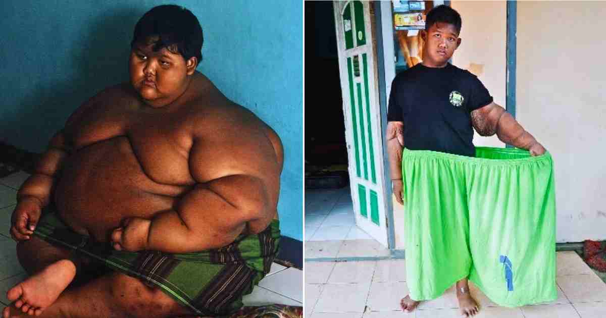 Arya, The Former “World’s Fattest Kid” Lost Weight