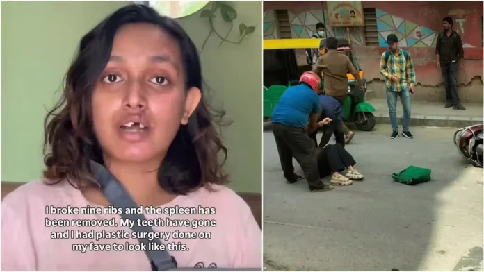 bengaluru-woman-sues-rapido-after-bike-crash-leaves-her-with-rs-20-lakh-hospital-bill-rapido-responds