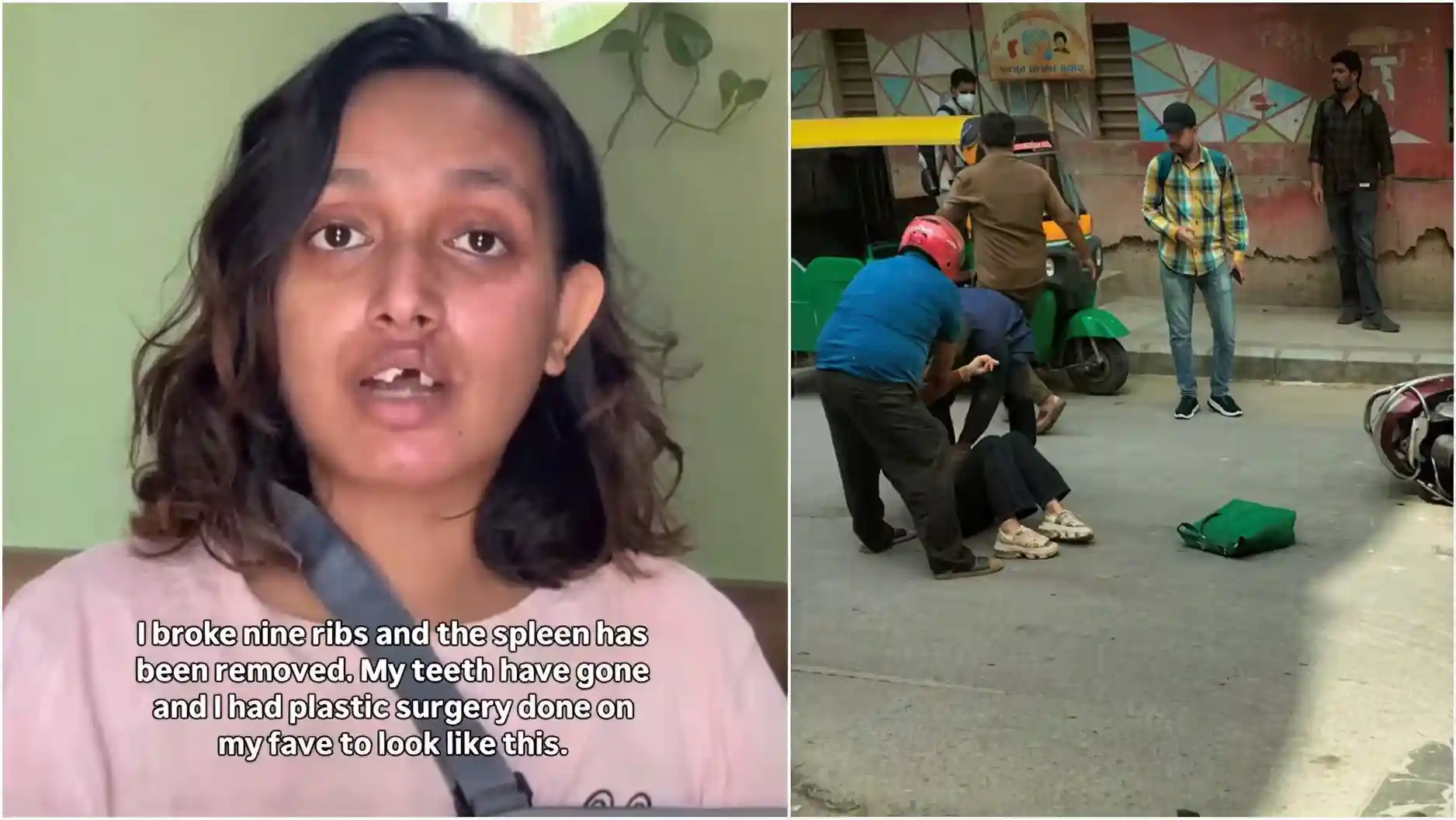 Bengaluru Woman Sues Rapido After Bike Crash Leaves Her With Rs 20 Lakh Hospital Bill, Rapido Responds
